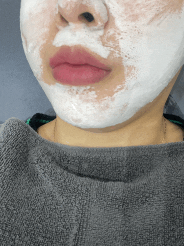  환절기 촉촉한 피부관리를 위한 모공디톡스, 바이오글로잉 추천 : 에떼르 서면2호점