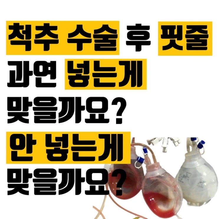  척추 수술 후 핏줄, 과연 넣는게 맞을까요? 안 넣는게 맞을까요?