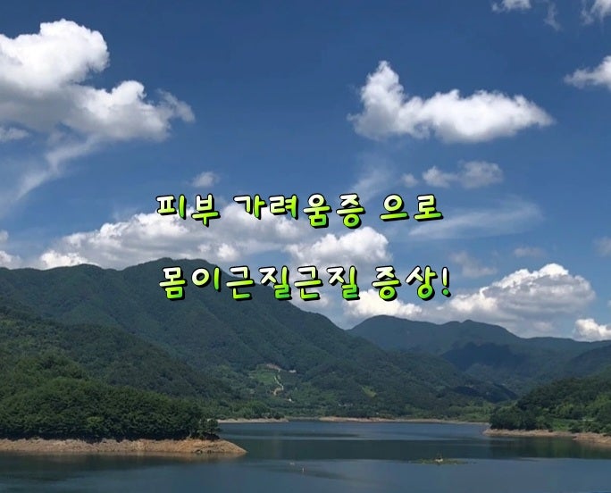 피부 가려움증 으로 몸이근질근질 증상! 피부 가려움증 으로 몸이근질근질 증상!