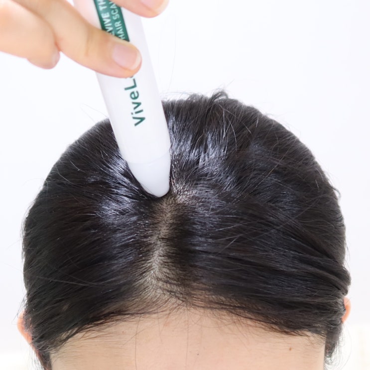  두피각질 생기는 원인 찾고, 두피앰플로 관리 해보기