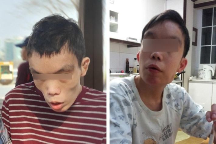 정부 지원에 '울고 웃는' 장애인 가정…"시설만은 안 갈래요" 정부 지원에 '울고 웃는' 장애인 가정…"시설만은 안 갈래요"