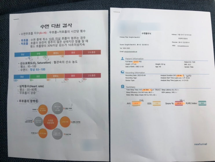 수면 다원 검사 후기 수면 다원 검사 후기