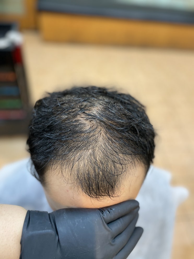  남자탈모펌과 탈짱샘의 한판승부 부산사상르네시떼미용실/감전주례모라학장덕천김해대동녹산명지용원창원밀양거제경남경북전라대구울산양산구미진주창원장유명지화명해운대용원민락동용호동남천동수영감만동