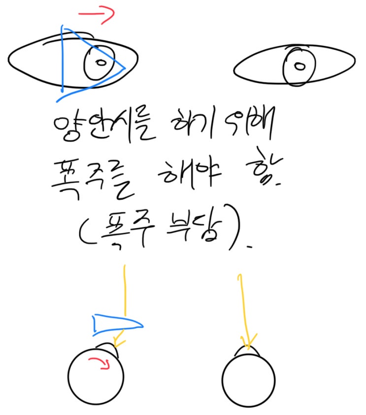  (안경사국가고시) 유발사위 완벽하게 이해하기