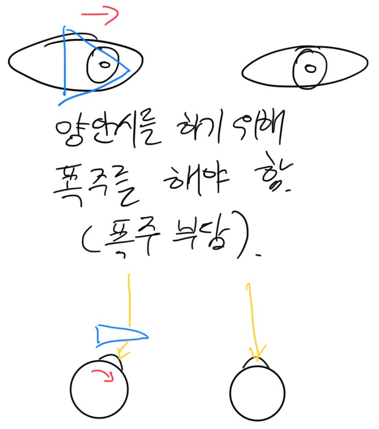 (안경사국가고시) 유발사위 완벽하게 이해하기