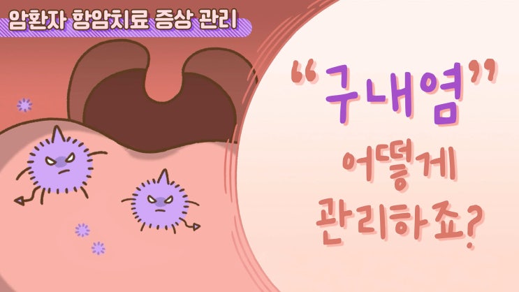  암환자 항암치료 증상_구내염 관리법