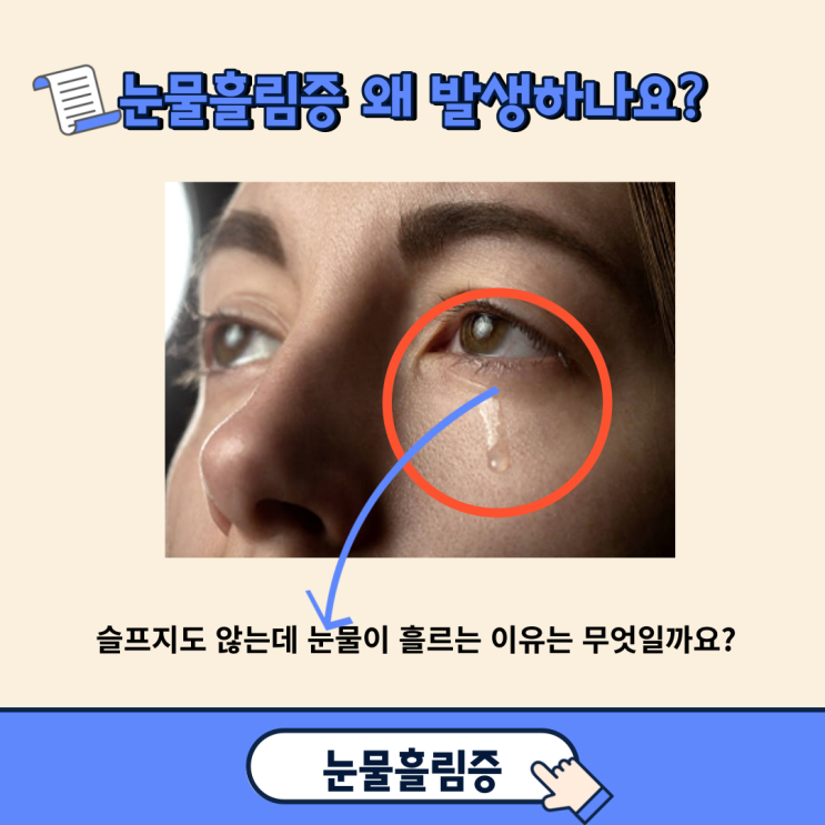 눈물흘림증 왜 발생하나요?(feat. 치료법)