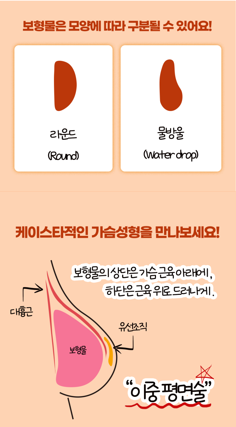 광주가슴성형잘하는곳 보형물을 사용한 확대방법은 여기! : 네이버 블로그