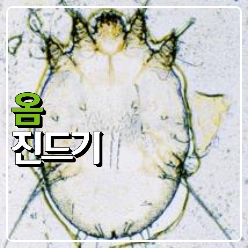 옴 증상 전염 진드기 물렸을때 치료법 (발가락 손가락 배꼽 간지러움) : 네이버 블로그