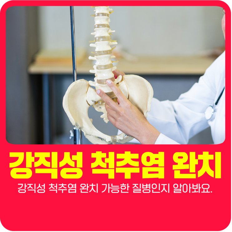  강직성 척추염 완치 가능한 질병인지 알아봐요.