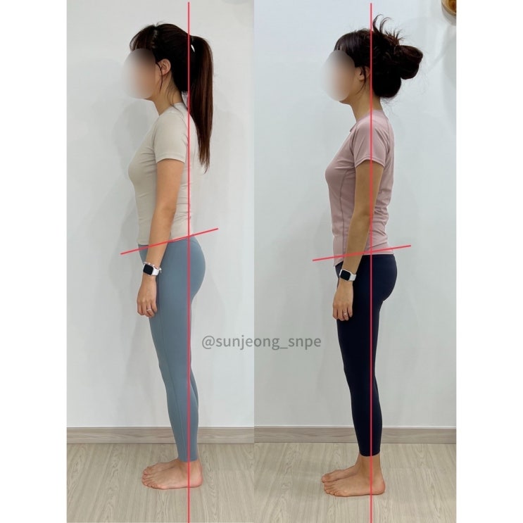  [대구SNPE 리셋바디] 무게중심 회복하신 회원님 비포에프터