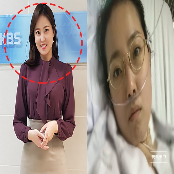 오수진 기상캐스터 심장 이식수술 나이 프로필 인스타 결혼 남편