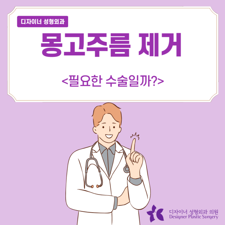  몽고주름 제거 필요한 수술일까? (실제 사례, 경과 후기)