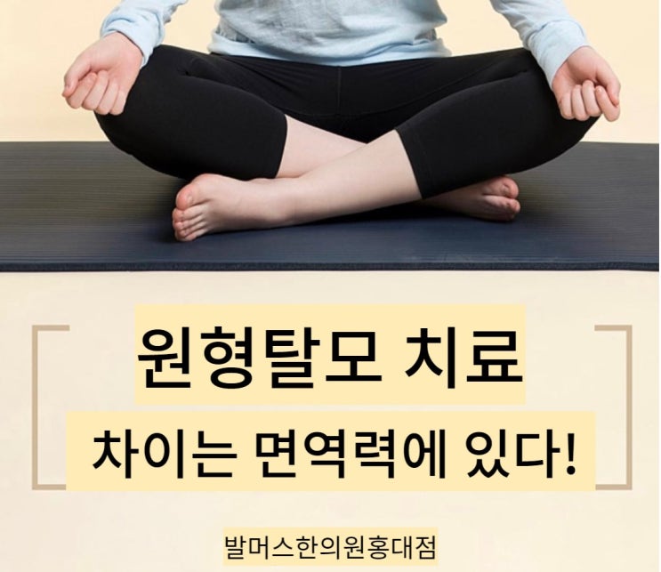  원형탈모가 속한 자가면역질환 치료 이야기 (자가면역 질환 치료의 특수성을 알아봅시다.)