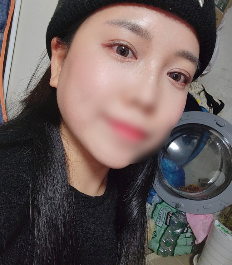  신사역 자연유착쌍꺼풀 수술 솔직하고 생생한 후기!! ( 한달 후 )