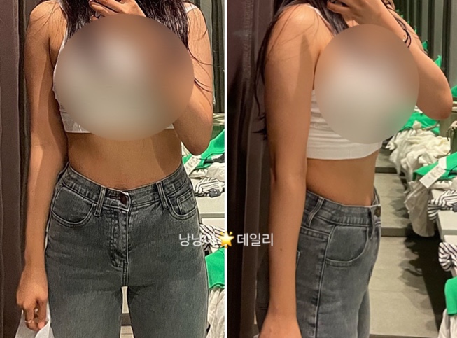  날씬해질 상상! 다이어트 의원 : 복부 8회차/ 팔뚝 3회차 후기