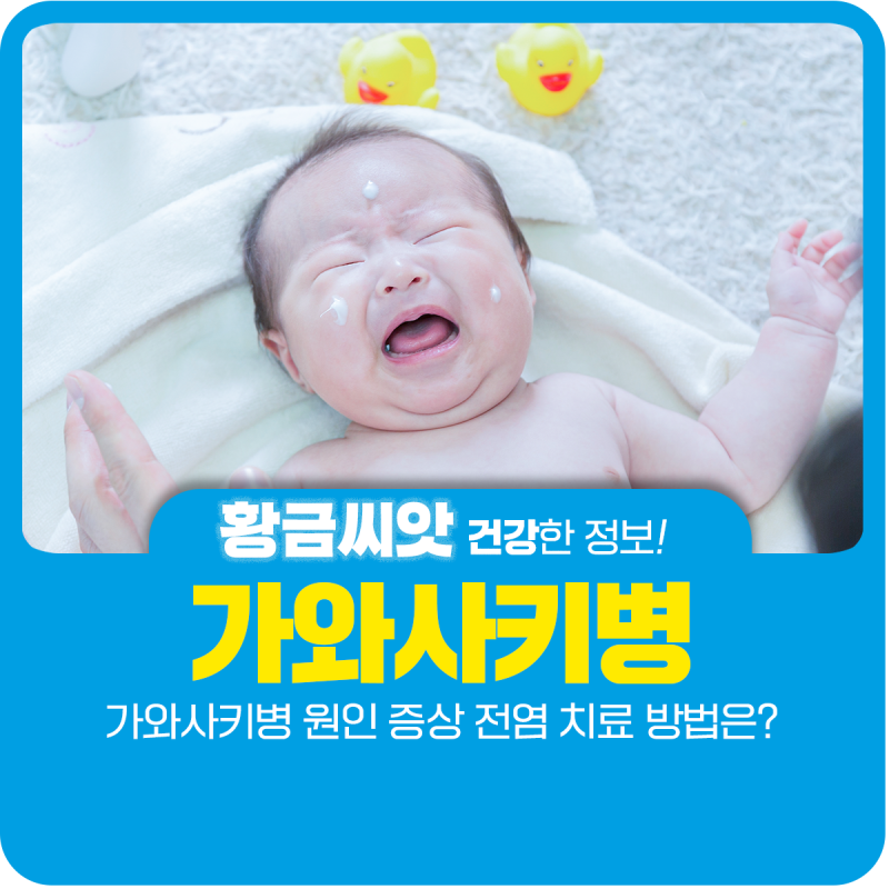 가와사키병 원인 증상 전염 치료 방법은?