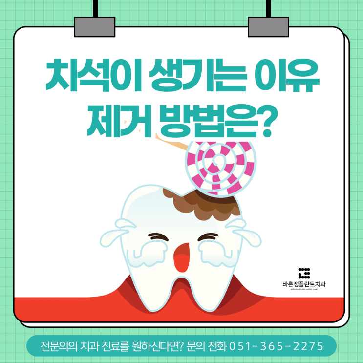  양산치과 치석 생기는 이유 그리고 제거 방법!
