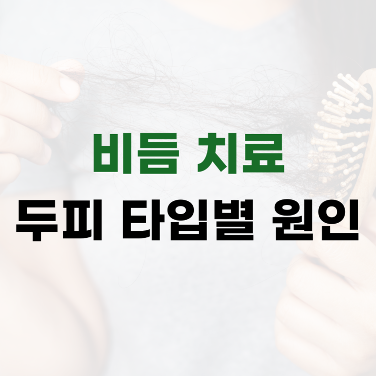  머리 비듬치료 두피 타입별 원인 파악이 중요합니다