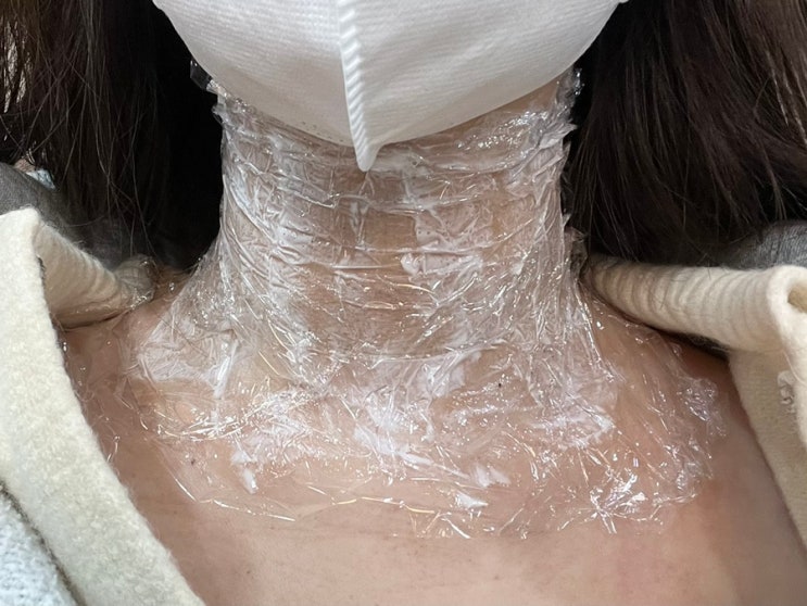  편평사마귀 내인생에서 사라져주렴.. (신촌 노벨의원 한달 후기)