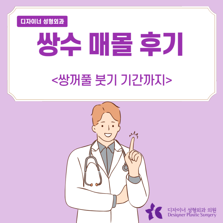  쌍수 매몰 후기 쌍꺼풀 붓기 기간까지