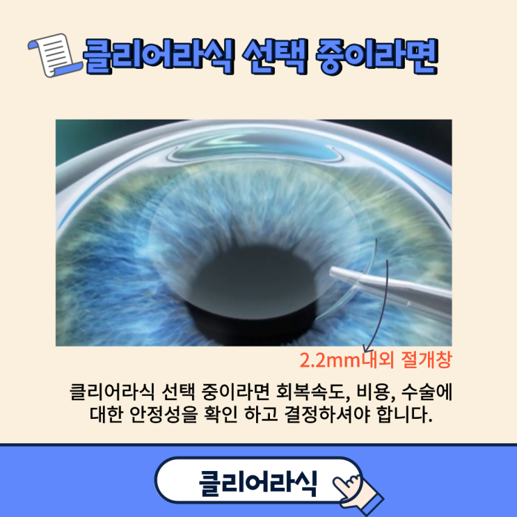  클리어라식과 스마일라식 고려하는 상태라면