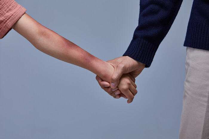 ‘동반 자살’ 아닙니다…“자녀 살해, 극단적 형태의 아동학대” ‘동반 자살’ 아닙니다…“자녀 살해, 극단적 형태의 아동학대”