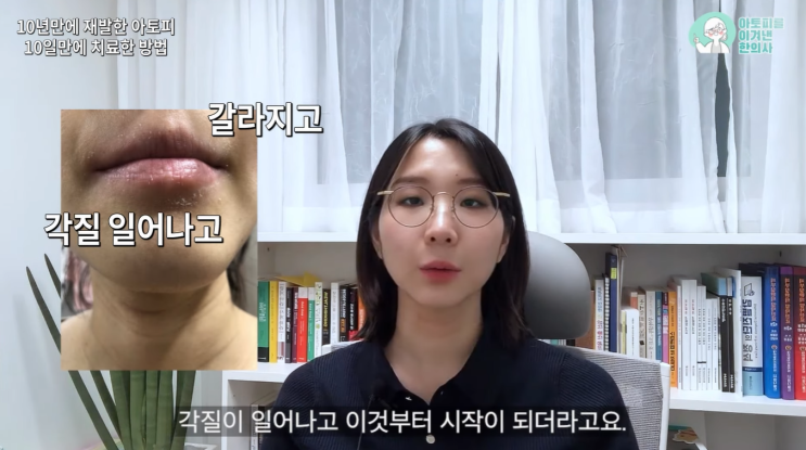  10년 박탈성 구순염 환자였던 한의사의 립밤 선택법(각질·진물 날때 보습 꿀팁)
