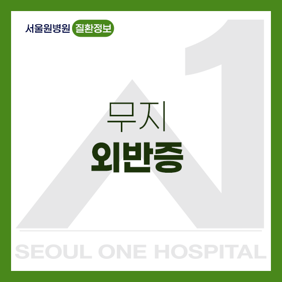 강서구 무지외반증 방치할수록 변형이 심해져요