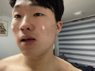  [남자피부관리] VT 리들샷 100으로 여드름 가라앉히기