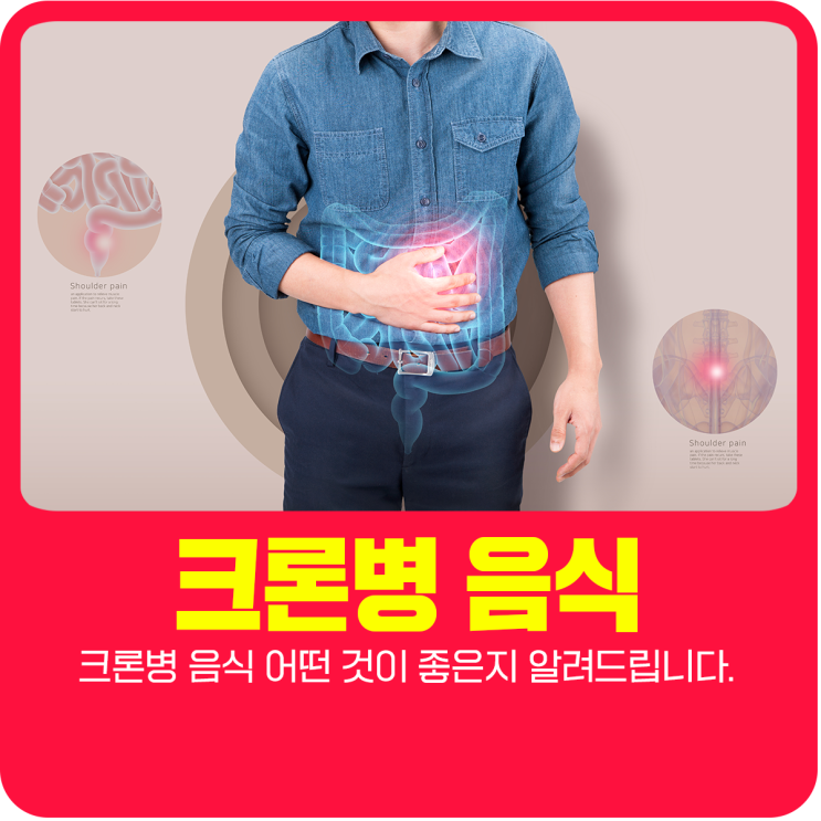  크론병 음식 어떤 것이 좋은지 알려드립니다.