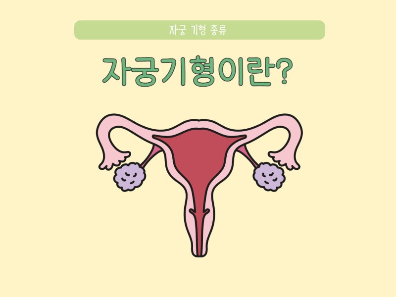 자궁기형 종류(중복, 쌍각, 중격, 단강, 궁형) 여성 난임 원인 증상(자궁2개) : 네이버 블로그