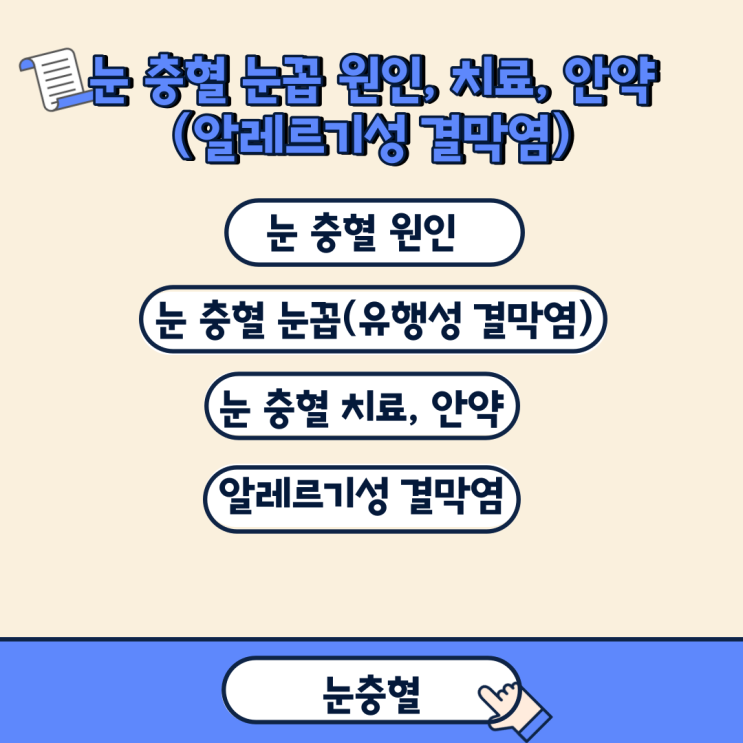  눈 충혈 눈꼽 원인, 치료, 안약(알레르기성 결막염)