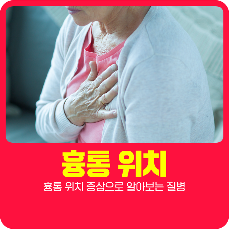  흉통 위치 증상으로 알아보는 질병