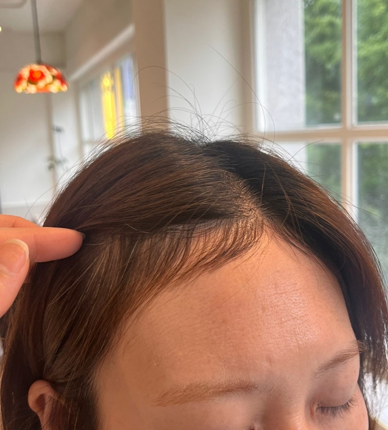 부산 전포동 서면 헤어살롱, 부산 브러싱 펌용 M자형 이마커버, '엉덩이머리, 이마라인 보정' _ 태희 얼굴형에 따른 다양한 브러싱! 5