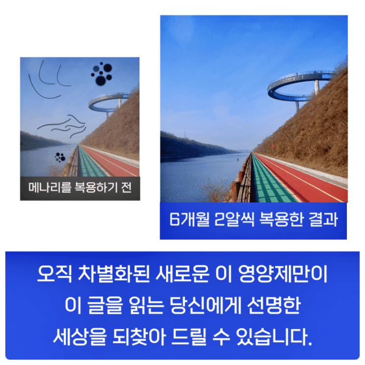  비문증영양제 복용해도 만족스럽지 않았던 이유란?