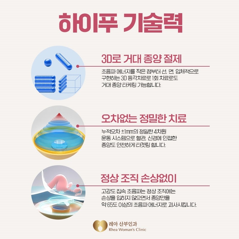 자궁근종 하이프 결과에 대한 자신감