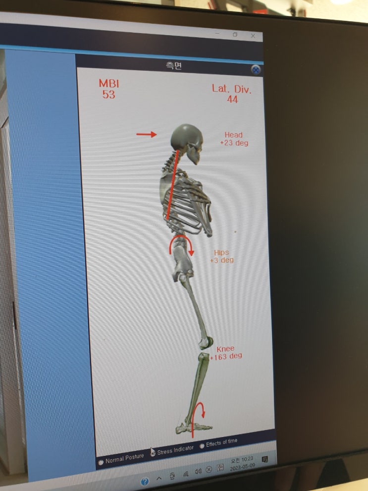 <b>경대병원역</b>체형교정 우리들 척추 운동센터
