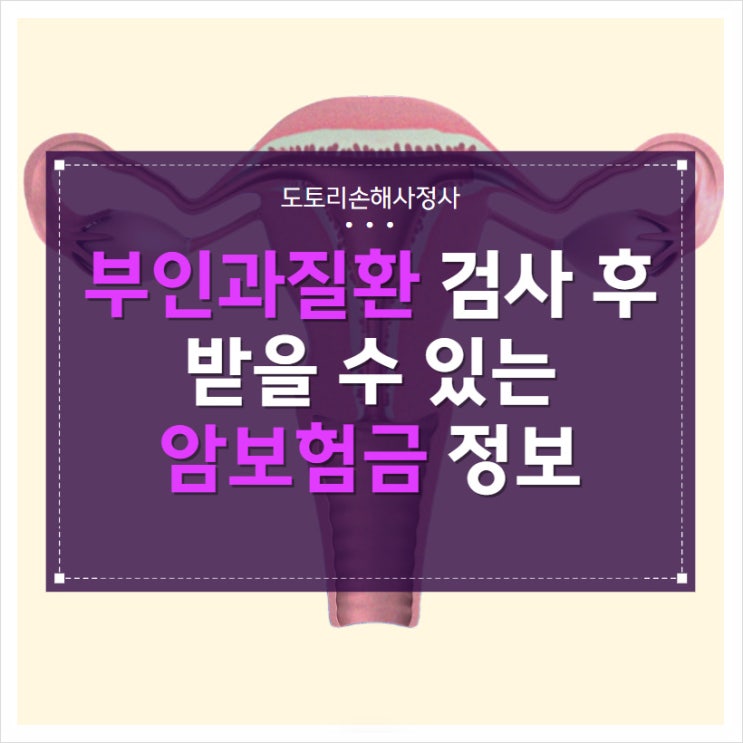 부인과질환 검사 후 받을 수 있는 암보험금