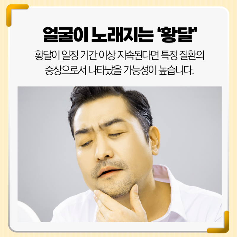 황달 증상 있을 때 의심할 수 있는 질환 : 네이버 블로그