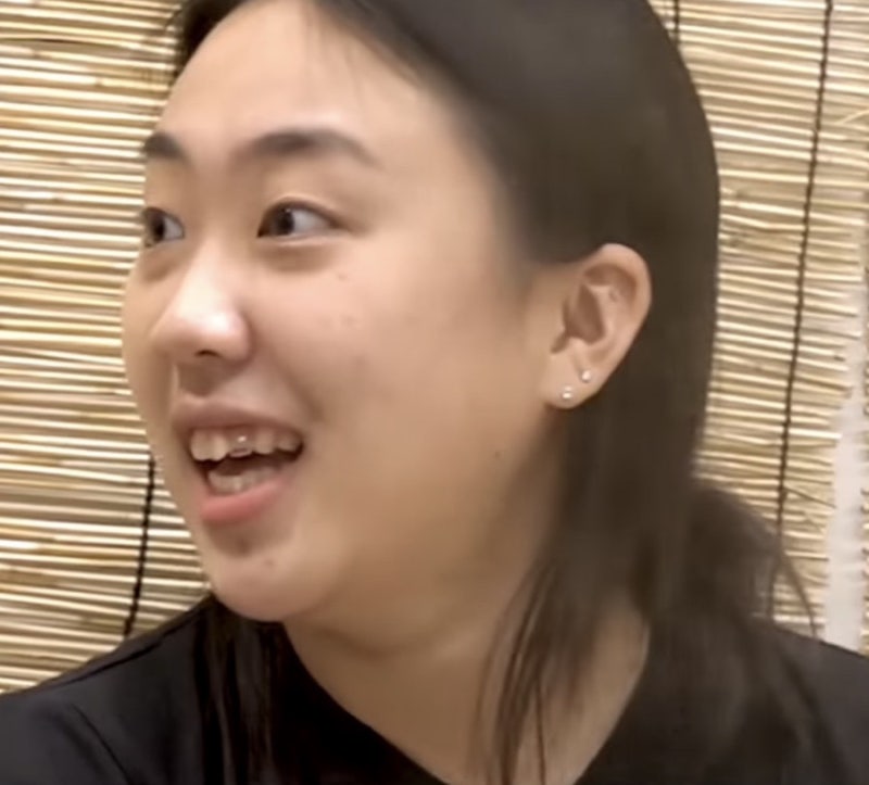 이영지 투스젬 뜻, 그릴즈 차이, 소요시간, 가격, 부작용은?