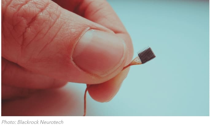  신경 질환 치료 위해 뇌에 칩 이식 VIDEO: Scientists Use Brain Implants to Help Patients Regain Their Independence