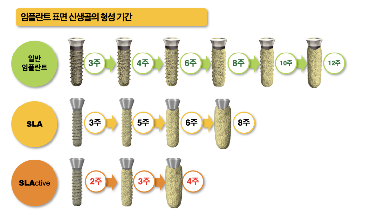  신논현역 치과, 세계 1위 임플란트 정품만을 사용하면 일어나는 변화