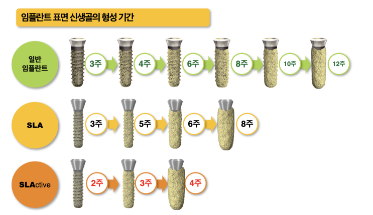 신논현역 치과, 세계 1위 임플란트 정품만을 사용하면 일어나는 변화