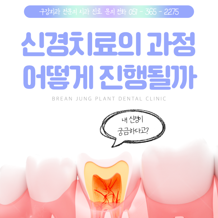  덕천치과 자연치아 지키는 신경치료 과정 알아보기!