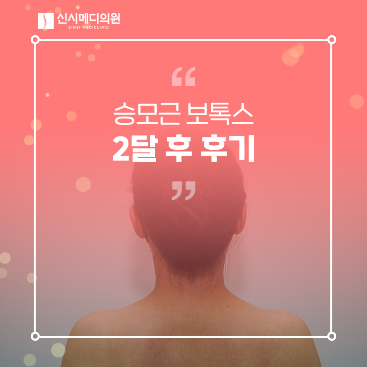  전주승모근보톡스 2달 후 찐후기