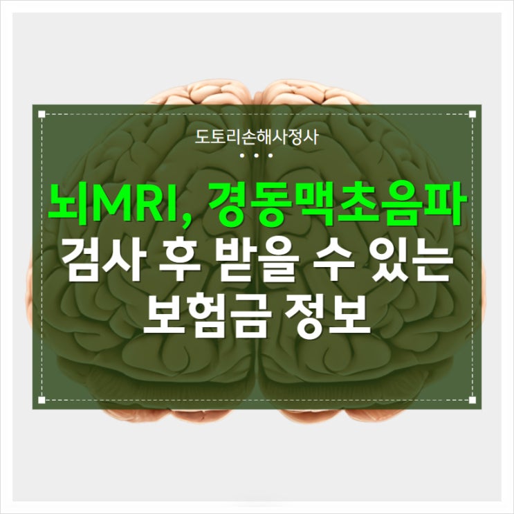 뇌MRI, 경동맥초음파 검사 후 받을 수 있는 보험금