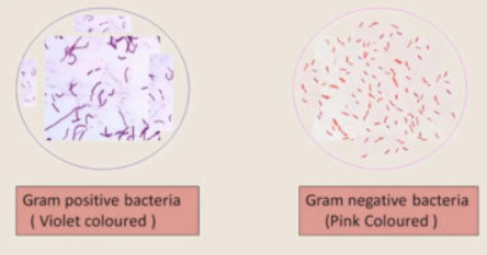 The Processes Involved In Gram Staining : 네이버 블로그