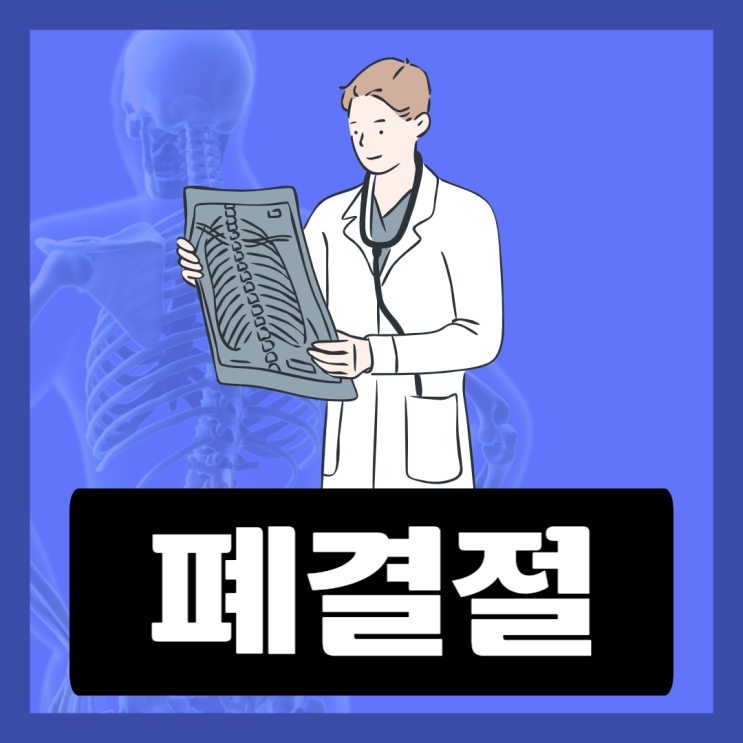 건강검진 폐결절 폐암 초기 증상 원인 조직검사 알아보고 예방해요 건강검진 폐결절 폐암 초기 증상 원인 조직검사 알아보고 예방해요