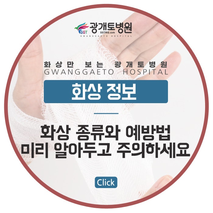 구미화상병원, 화상의 종류와 예방법 미리 알아두고 주의하세요